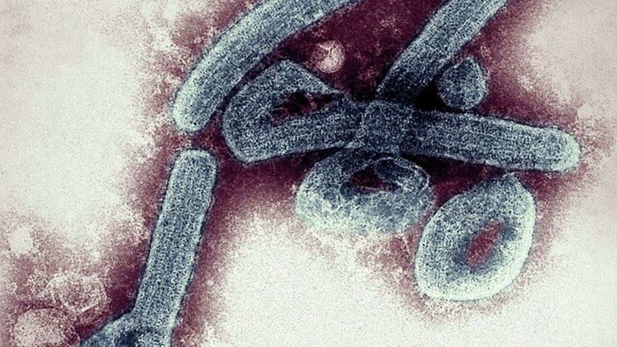تایید اولین موارد ویروس مرگبار ماربورگ در غنا

