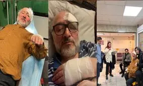 سیدمحمد ابطحی مجروح شد/ ۱۰ بخیه روی ابرو و ترک خوردن قفسه سینه 