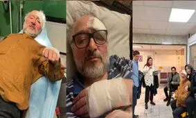 سیدمحمد ابطحی مجروح شد/ ۱۰ بخیه روی ابرو و ترک خوردن قفسه سینه 