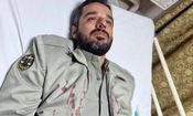 محیط‌بان کازرونی در عملیات حفاظت از بلوط‌ها مجروح شد