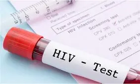 حکم حبس برای پنهان‌ کردن بیماری HIV قبل از ازدواج در استانبول
