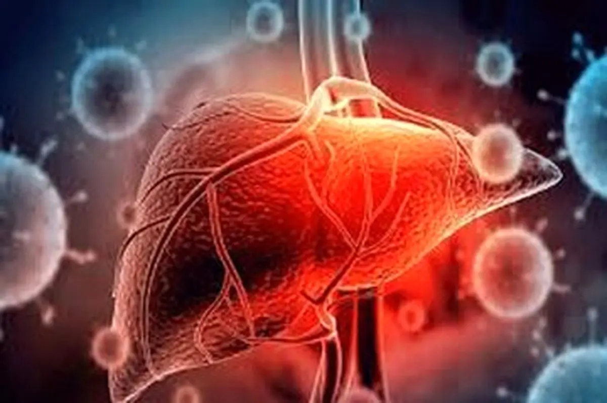 غذاهای مضر برای کبد چرب