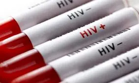 ۸۱ درصد مبتلایان به HIV مرد هستند