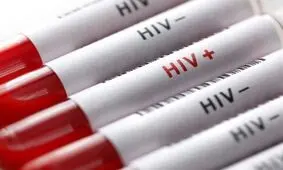 ۸۱ درصد مبتلایان به HIV مرد هستند