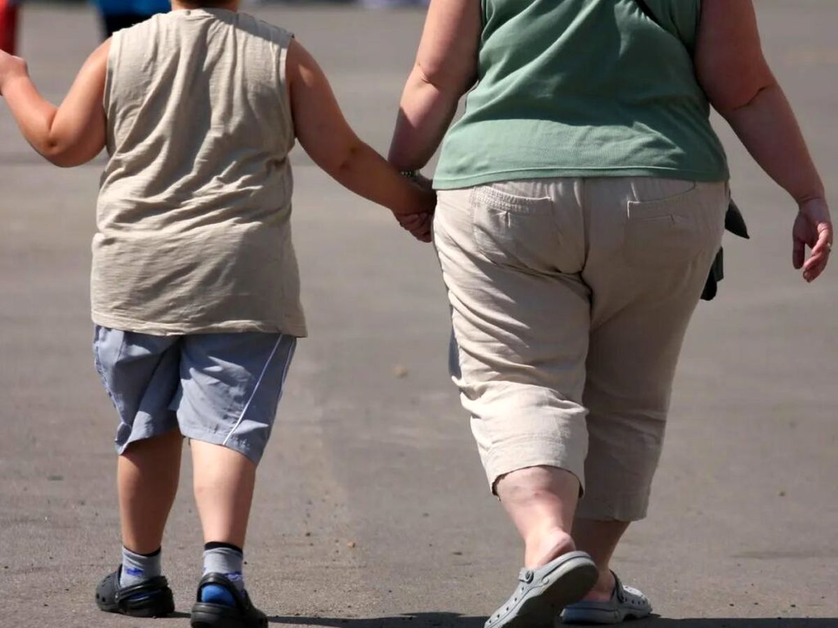 نتایج یک مطالعه: چاقی در کودکان احتمالاً خطر ابتلا به ام‌اس را دو برابر می‌کند