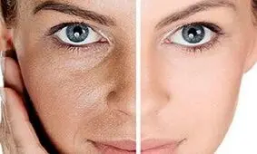 این میوه‌ها برای سلامت پوست معجزه می‌کنند