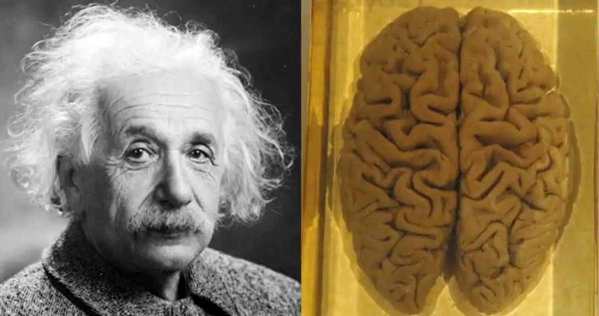 مغز آلبرت اینشتین در شیشه/ چه تفاوتی با مغز دیگران مشاهده شد؟

