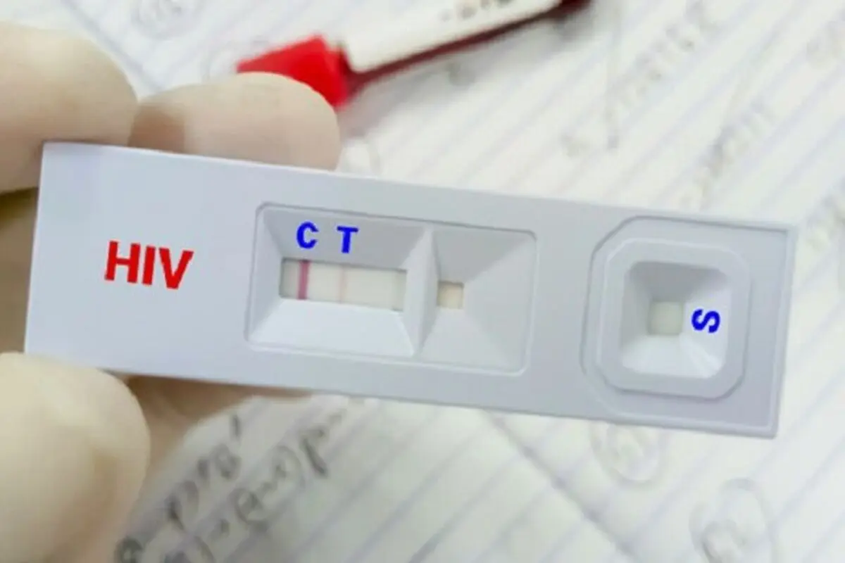 کاهش سهم «اعتیاد» در انتقال HIV؛ توضیح وزارت بهداشت درباره تغییر الگوی انتقال بیماری
