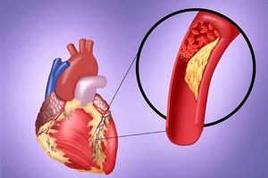 خون بدهید تا سکته قلبی نکنید