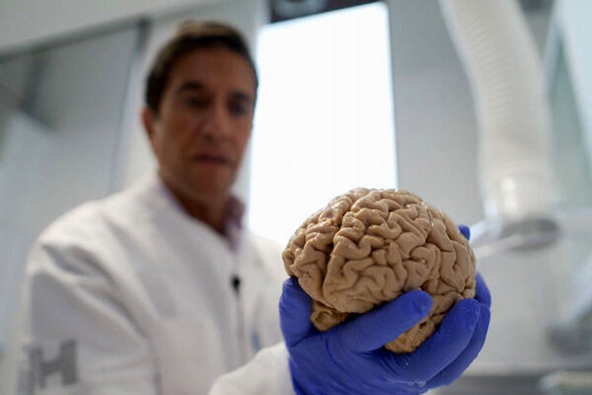 مغز ساخته شده توسط دانشمندان در آزمایشگاه، برای خود چشم ساخت!/ عکس

