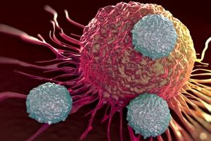 شایع ترین سرطان‌ها در بین مردان و زنان