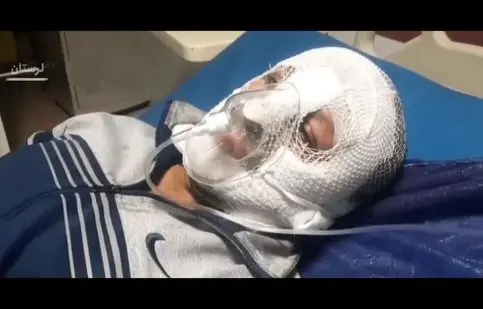 سوختگی صورت یک مامور انتظامی در کوهدشت/ ویدئو