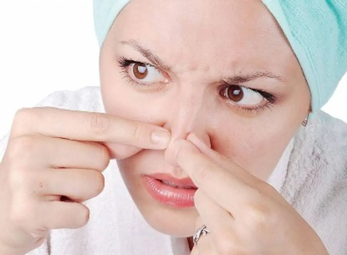 با جوش‌ های روی بینی چه کنیم؟