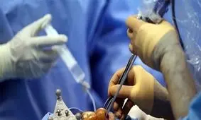 اولین عمل بینی در ایران را چه کسی انجام داد؟