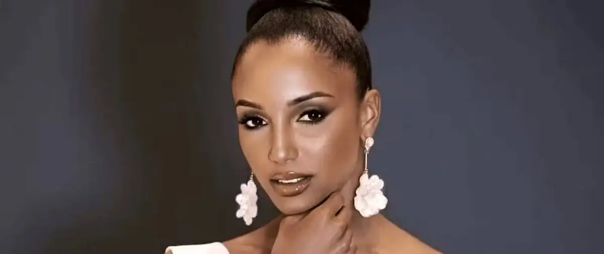 حال ملکه زیبایی جامائیکا که از سن سقوط کرد وخیم شد 