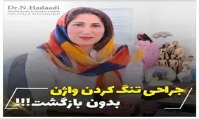 تفاوت پرینورافی و واژینوپلاستی