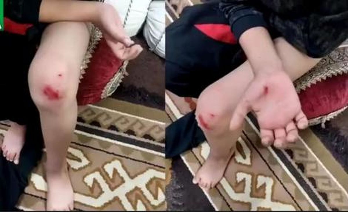 حمله سگ‌های ولگرد به کودک یاسوجی/ ویدئو