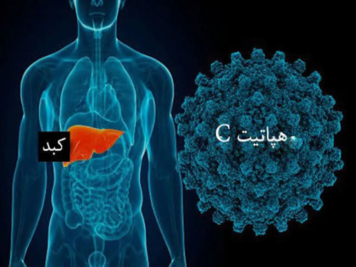 هپاتیت C بیماری خاموش بدون واکسن 