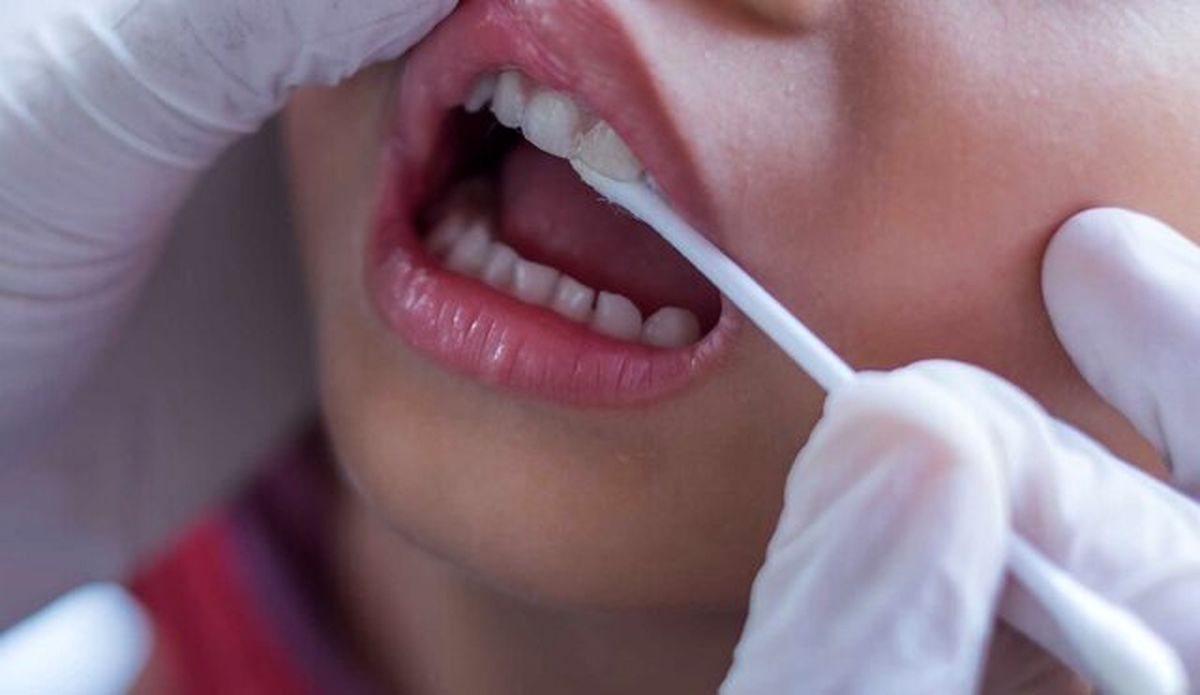 استرس بر دهان و دندان چه تاثیری دارد؟
