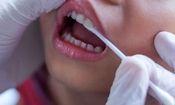 استرس بر دهان و دندان  چه تاثیری دارد؟