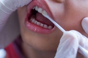استرس بر دهان و دندان  چه تاثیری دارد؟