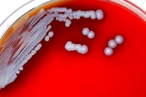 باکتری یک بیماری نادر و خطرناک از آب و خاک جنوب آمریکا سر درآورد 