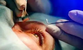 حکم قطعی پرونده نابینا شدن ۹ نفر در بیمارستان «نگاه»؛ پزشکان تبرئه شدند، بیمارستان هم فقط «دیه» می‌دهد