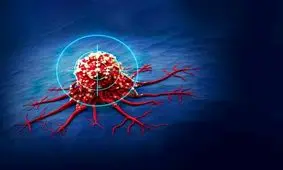 علائم پنهان یک سرطان در آقایان/ اینفوگرافی