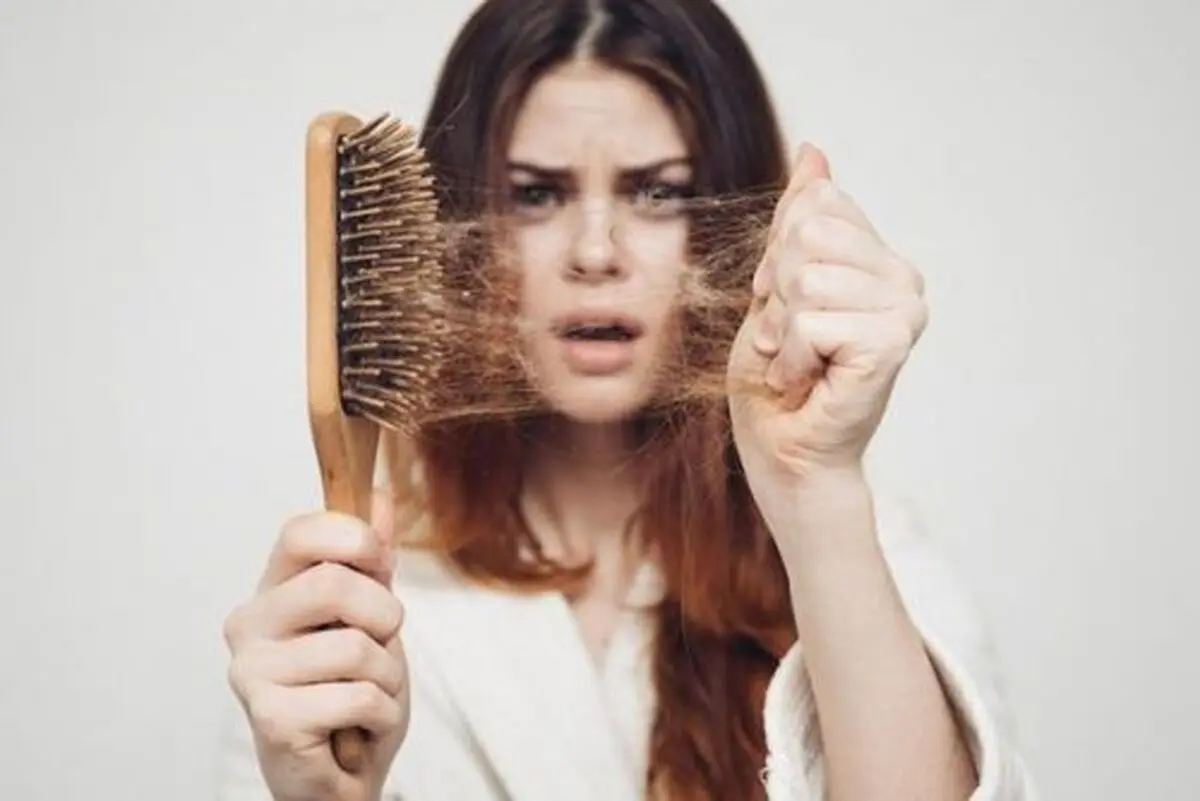  جلوگیری از کچلی و ریزش مو