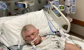 حمله ۲۰ هزار زنبور به مرد آمریکایی او را به کما برد