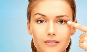 درمان خانگی افتادگی پلک