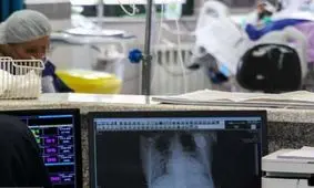 آثار جبران‌ ناپذیر کرونا بر شناسایی مبتلایان سل