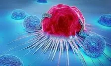 در ایران بین ۳۰ تا ۴۰ دقیقه، یک زن به سرطان سینه مبتلا می‌شود/ هر سال ۲۰ هزار بیمار جدید داریم 