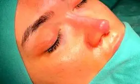 چرا ایرانیان عاشق جراحی بینی و زیبایی هستند؟