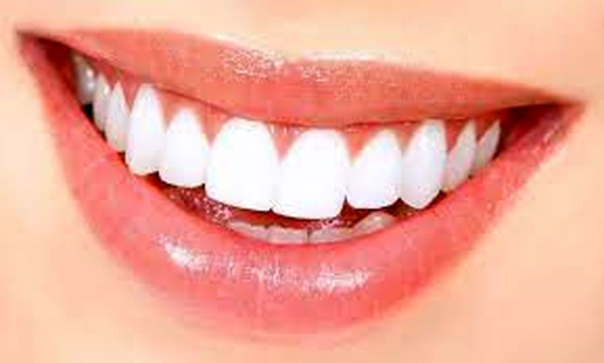 چگونه تا عید دندان های سفید و دهان خوشبو داشته باشیم؟/ ویدئو