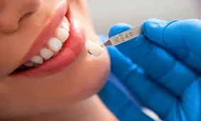 بررسی لمینت و کامپوزیت به عنوان گزینه‌ های موثر زیبایی لبخند