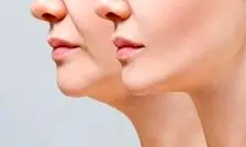 ویتامینی که کمبود آن باعث لاغری صورت می شود