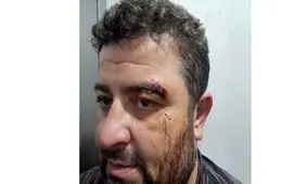 کتک خوردن ماموران یگان حفاظت شفت