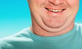 چگونه از شر غبغب یا دو چانه بودن بدون جراحی خلاص شویم؟