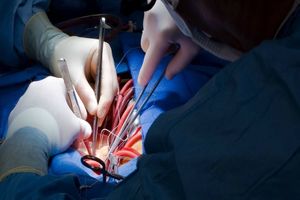 افشای درخواست ۳۰۰۰ یورویی پزشک معروف برای عمل قلب!