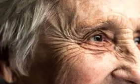 چرا با بالا رفتن سن پوستمان چروک می‌شود؟