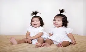 بیماری که دوقلوها را مبتلا می‌کند