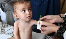 واریز دو مرحله یارانه رفع سوءتغذیه کودکان زیر ۵ سال