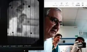 ایمپلنتی که میلیون‌ها نفر نابینا را از پیوند قرنیه بی‌نیاز می‌کند

