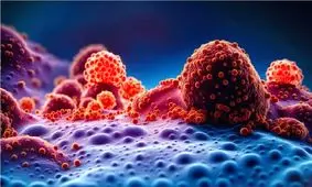 ارتباط مصرف الکل با بروز ۳ سرطان