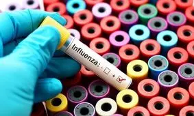 شیوع آنفلوآنزا نزولی شده اما همچنان بالاتر از سطح هشدار است/ بیشترین گردش ویروس در افراد ۵ تا ۱۴ ساله است
