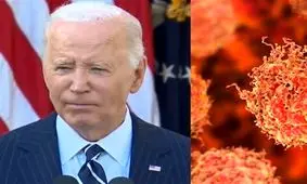 بایدن تحت عمل جراحی سرطان پوست قرار گرفت