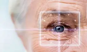 این مشاغل، خطر پارگی شبکیه چشم را بالا می‌برند