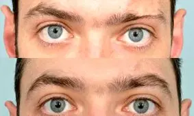 آیا مردان می توانند کاشت ابرو انجام دهند؟ 