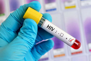 افزایش ۱۰ برابری ابتلاء زنان به ایدز